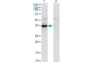 Western Blot analysis of PANK1 expression in transfected 293T cell line by PANK1 polyclonal antibody (A01). (PANK1 抗体  (AA 310-409))