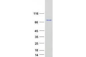 Validation with Western Blot (Radixin Protein (RDX) (Myc-DYKDDDDK Tag))