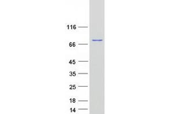 Radixin Protein (RDX) (Myc-DYKDDDDK Tag)