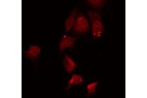 ABIN6267028 staining 293 by IF/ICC. (AKT1 抗体  (C-Term))