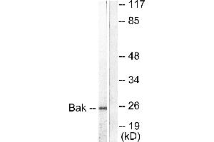 Western blot analysis of extracts from 293 cells, using Bak antibody (#C0131). (BAK1 抗体)
