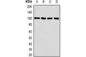 Western blot analysis of CLCN5 expression in HepG2 (A), THP1 (B), mouse kidney (C), mouse brain (D) whole cell lysates. (Chloride Channel 5 抗体)