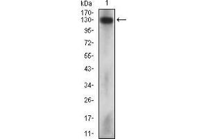 Fig. (MCAM 抗体  (AA 84-189))