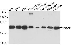 Western blot analysis of extracts of various cell lines, using CRYAB antibody. (CRYAB 抗体)