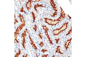 Immunohistochemistry of paraffin-embedded rat kidney using Syntaxin 3 Rabbit mAb (ABIN7270686) at dilution of 1:100 (40x lens). (STX3 抗体)