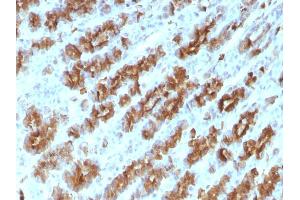 Immunohistochemistry (IHC) image for anti-Tumor Necrosis Factor alpha (TNF alpha) antibody (ABIN6940753)