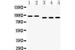 Western Blotting (WB) image for anti-Discs, Large Homolog 4 (Drosophila) (DLG4) (AA 581-724) antibody (ABIN3043563) (DLG4 抗体  (AA 581-724))