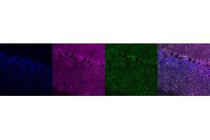 Immunohistochemistry (IHC) image for anti-CD63 (CD63) antibody (ABIN7456346)