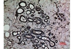 Immunohistochemical analysis of paraffin-embedded human-breast, antibody was diluted at 1:100. (HMGB1 抗体  (acLys12))