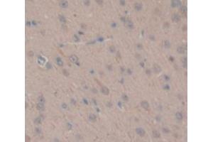 IHC-P analysis of Rat Tissue, with DAB staining. (TGM1 抗体  (AA 504-737))