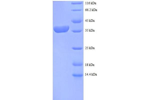 RPS12 Protein (AA 1-132, full length) (GST tag)