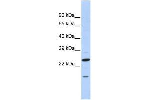 WB Suggested Anti-INSIG2 Antibody Titration:  0. (INSIG2 抗体  (N-Term))