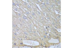 Immunohistochemistry of paraffin-embedded human liver using RPH3AL antibody. (RPH3AL 抗体  (AA 161-315))