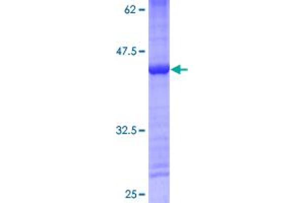 RPS14 Protein (AA 1-128) (GST tag)