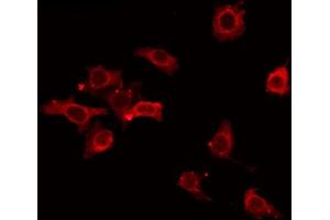 ABIN6268806 staining Hela by IF/ICC. (CD6 抗体  (Internal Region))