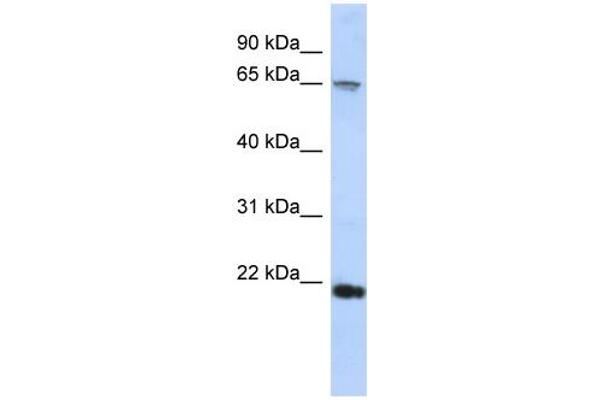 FSBP 抗体  (C-Term)