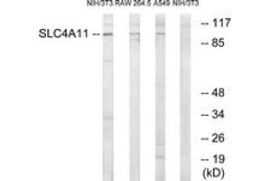 Western Blotting (WB) image for anti-Solute Carrier Family 4, Sodium Borate Transporter, Member 11 (SLC4A11) (AA 291-340) antibody (ABIN2890638) (SLC4A11 抗体  (AA 291-340))