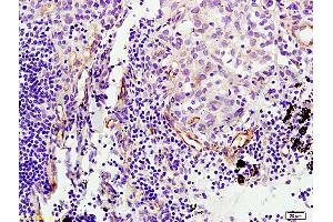 Immunohistochemistry (IHC) image for anti-Endoglin (ENG) (AA 58-110) antibody (ABIN707561)