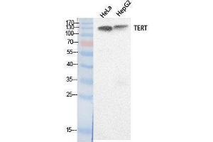 Western Blotting (WB) image for anti-Telomerase Reverse Transcriptase (TERT) (Internal Region) antibody (ABIN3178530) (TERT 抗体  (Internal Region))