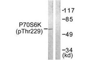 Western blot analysis of extracts from Jurkat cells, using p70 S6 Kinase (Phospho-Thr229) Antibody. (RPS6KB1 抗体  (pThr229))
