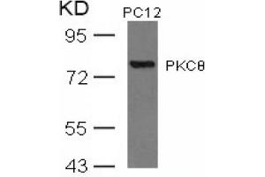 Image no. 3 for anti-Protein Kinase C, theta (PRKCQ) (AA 674-678) antibody (ABIN197567) (PKC theta 抗体  (AA 674-678))