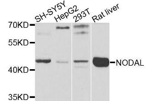 Western blot analysis of extracts of various cell lines, using NODAL antibody (ABIN6003633) at 1/1000 dilution. (Nodal 抗体)