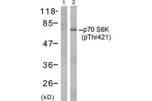 Western blot analysis of extracts from Jurkat cells, untreated or treated with GM-CSF (25ng/ml 30min) using p70 S6 Kinase (phospho-Thr421) antibody (E011254, Line 1 and 2). (RPS6KB1 抗体  (pThr421))