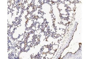 Immunohistochemistry analysis of paraffin-embedded Rat lung using VWF Polyclonal Antibody at dilution of 1:500. (VWF 抗体)