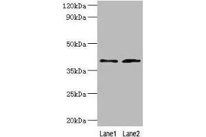 Western blot All lanes: DCN antibody at 2 μg/mL Lane 1: Mouse heart tissue Lane 2: HepG2 whole cell lysate Secondary Goat polyclonal to rabbit IgG at 1/10000 dilution Predicted band size: 40, 28, 24, 20, 9 kDa Observed band size: 40 kDa (Decorin 抗体  (AA 20-359))