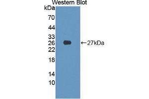 Western blot analysis of the recombinant protein. (PIM2 抗体  (AA 82-291))