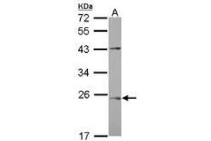 Image no. 1 for anti-Chromosome 1 Open Reading Frame 146 (C1ORF146) (AA 1-180) antibody (ABIN1497028) (C1ORF146 抗体  (AA 1-180))