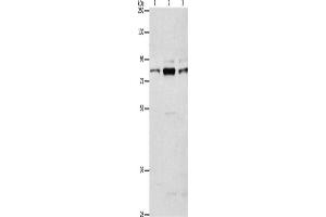Western Blotting (WB) image for anti-rho Guanine Nucleotide Exchange Factor (GEF) 7 (ARHGEF7) antibody (ABIN2429254) (ARHGEF7 抗体)
