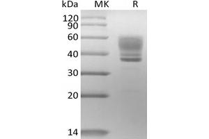 Western Blotting (WB) image for Interleukin 13 (IL13) protein (mFc Tag) (ABIN7319863) (IL-13 Protein (mFc Tag))