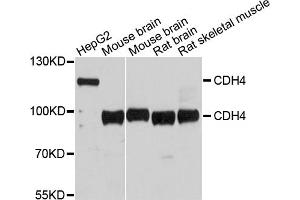 Western blot analysis of extracts of various cell lines, using CDH4 antibody (ABIN5997416) at 1/1000 dilution. (Cadherin 4 抗体)