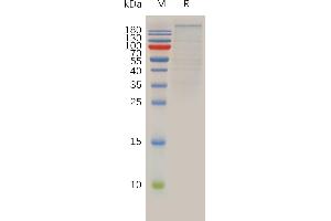 Human Protein, hFc Tag on SDS-PAGE under reducing condition. (BRD4 Protein (AA 1-1362) (Fc Tag))