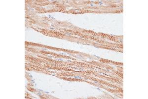 Immunohistochemistry of paraffin-embedded rat heart using GRK5 antibody (ABIN1680115, ABIN3018251, ABIN3018252 and ABIN6220413) at dilution of 1:100 (40x lens). (GRK5 抗体  (AA 371-590))
