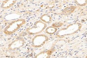 Immunohistochemistry analysis of paraffin-embedded human kidney using,IVD (ABIN7074382) at dilution of 1: 2800 (IVD 抗体)