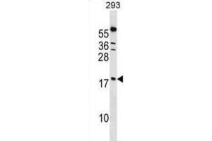 Western Blotting (WB) image for anti-Peptidylprolyl Isomerase (Cyclophilin)-Like 1 (PPIL1) antibody (ABIN2998971) (PPIL1 抗体)