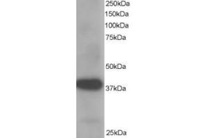 Western Blotting (WB) image for anti-Aldo-Keto Reductase Family 1, Member B1 (Aldose Reductase) (AKR1B1) (C-Term) antibody (ABIN2465387) (AKR1B1 抗体  (C-Term))