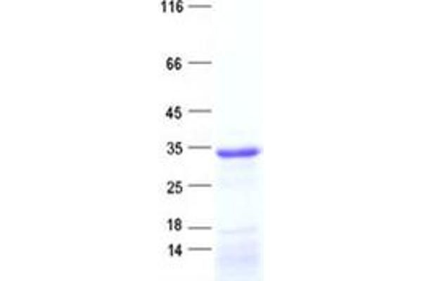 ASB11 Protein (His tag)