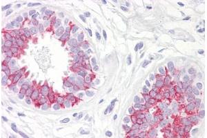 Anti-MAP2K1 / MEK1 antibody IHC staining of human breast. (MEK1 抗体  (AA 252-301))