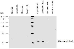 Western blotting analysis of human β2-microglobulin using mouse monoclonal antibody B2M-01 on lysates of various cell lines under reducing and non-reducing conditions. (beta-2 Microglobulin 抗体  (Biotin))