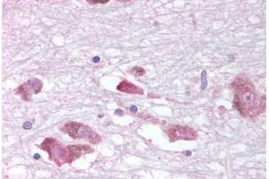 Human Brain, Substantia Nigra (formalin-fixed, paraffin-embedded) stained with MCHR1 antibody ABIN213354 at 10-18 ug/ml followed by biotinylated goat anti-rabbit IgG secondary antibody ABIN481713, alkaline phosphatase-streptavidin and chromogen. (MCHR1 抗体  (C-Term))