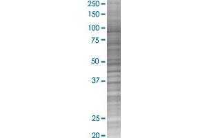 ELAVL3 transfected lysate. (ELAVL3 293T Cell Transient Overexpression Lysate(Denatured))