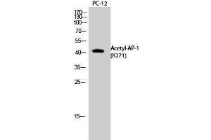 Western Blotting (WB) image for anti-Jun Proto-Oncogene (JUN) (acLys271) antibody (ABIN3178880) (C-JUN 抗体  (acLys271))