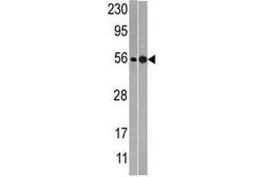 Image no. 1 for anti-60S Ribosomal Export Protein NMD3 (NMD3) (C-Term) antibody (ABIN357284) (NMD3 抗体  (C-Term))