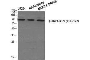 Western Blotting (WB) image for anti-AMPK1/AMPK2 (pThr172), (pThr183) antibody (ABIN5956005) (PRKAA1/PRKAA2 抗体  (pThr172, pThr183))