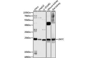 Western blot analysis of extracts of various cell lines, using LIN7C antibody (ABIN7268269) at 1:1000 dilution. (LIN7C 抗体  (AA 1-70))