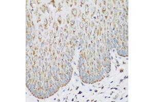 Immunohistochemistry of paraffin-embedded human esophagus using IGF2BP3 antibody. (IGF2BP3 抗体)