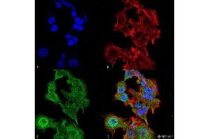 Immunocytochemistry/Immunofluorescence analysis using Mouse Anti-GFAP Monoclonal Antibody, Clone S206A-8 . (GFAP 抗体  (AA 411-422) (PE))